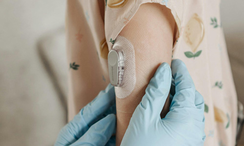 Wearable Medical Device1